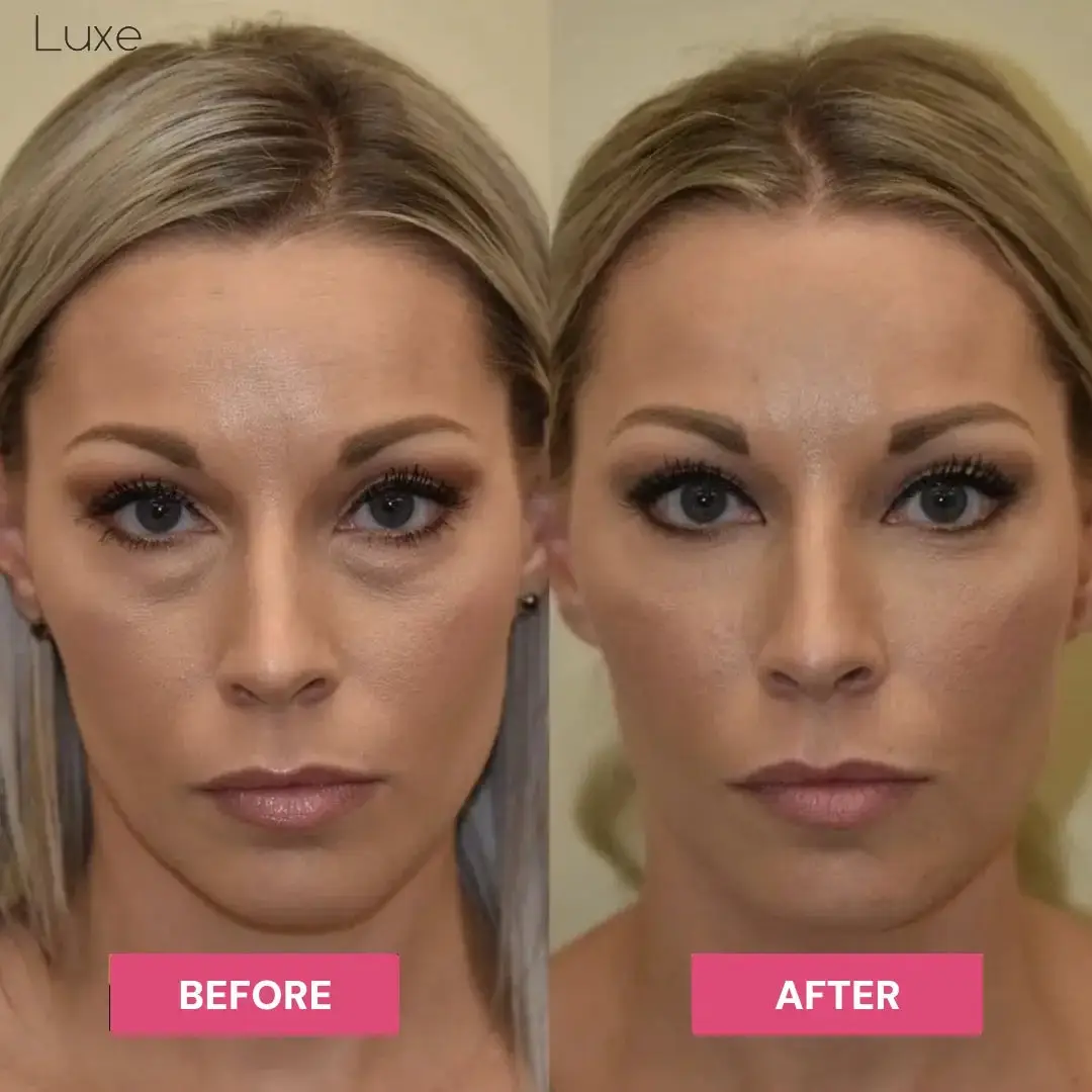 Luxe - Korean Under-Eye Balm - Image 9